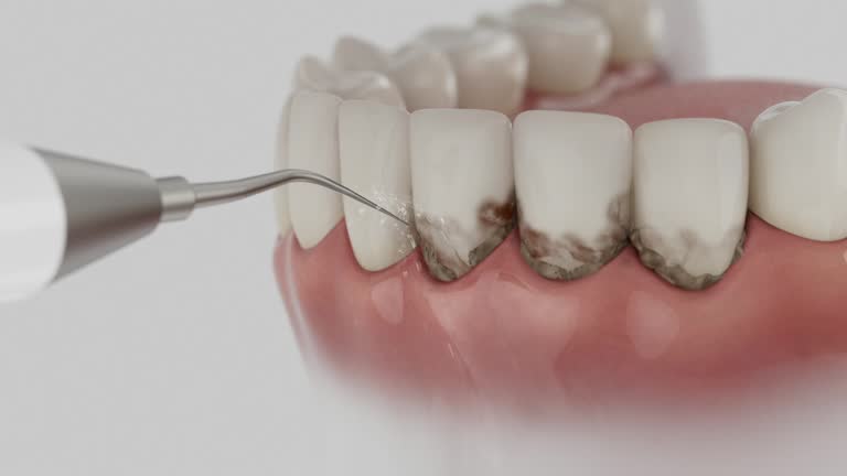 Reliable Dental contractor in Greenfield, OH by Dentist Open Now